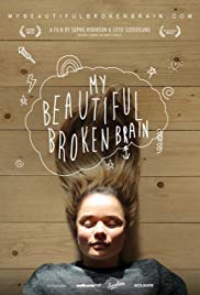 Watch Full Movie :My Beautiful Broken Brain (2014)