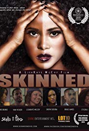 Watch Full Movie :Skinned (2015)